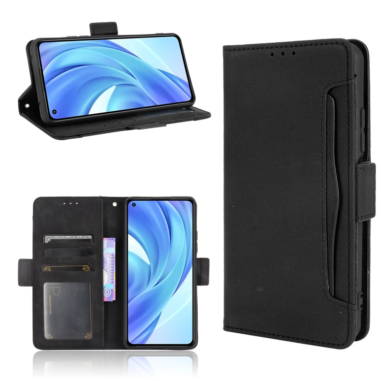 For Xiaomi Mi 11 Lite 4G / Mi 11 Lite 5G Skin Feel Calf Pattern Horizontal Flip Leather Case with Holder & Card Slots & Photo Frame