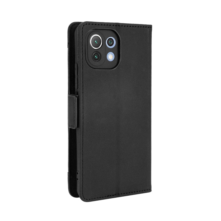 For Xiaomi Mi 11 Lite 4G / Mi 11 Lite 5G Skin Feel Calf Pattern Horizontal Flip Leather Case with Holder & Card Slots & Photo Frame