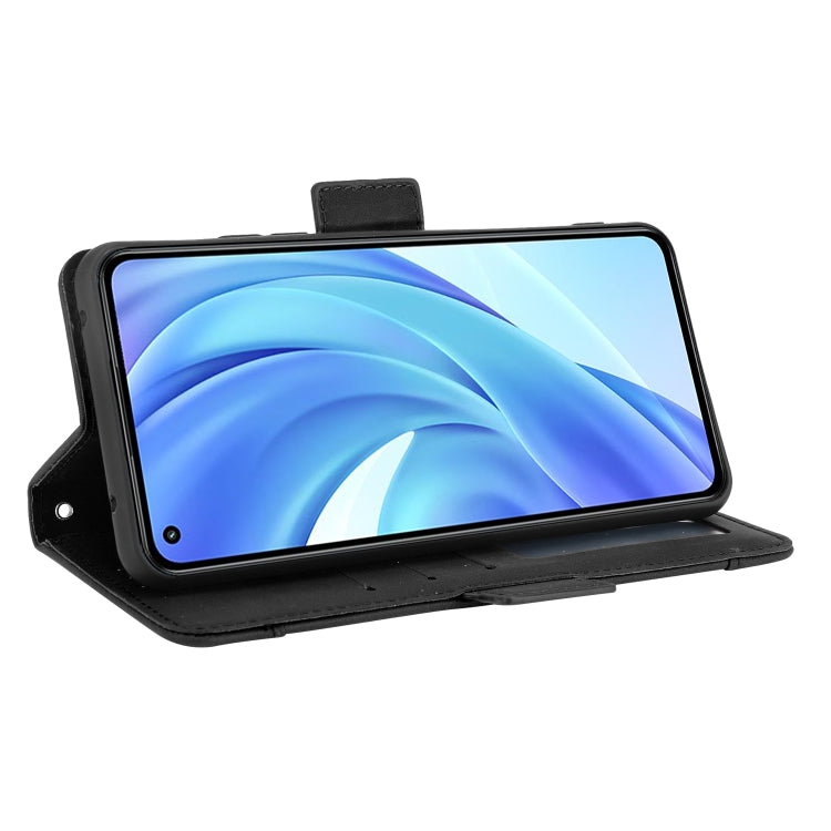 For Xiaomi Mi 11 Lite 4G / Mi 11 Lite 5G Skin Feel Calf Pattern Horizontal Flip Leather Case with Holder & Card Slots & Photo Frame