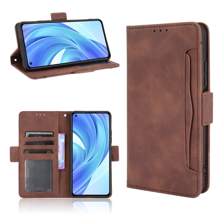 For Xiaomi Mi 11 Lite 4G / Mi 11 Lite 5G Skin Feel Calf Pattern Horizontal Flip Leather Case with Holder & Card Slots & Photo Frame