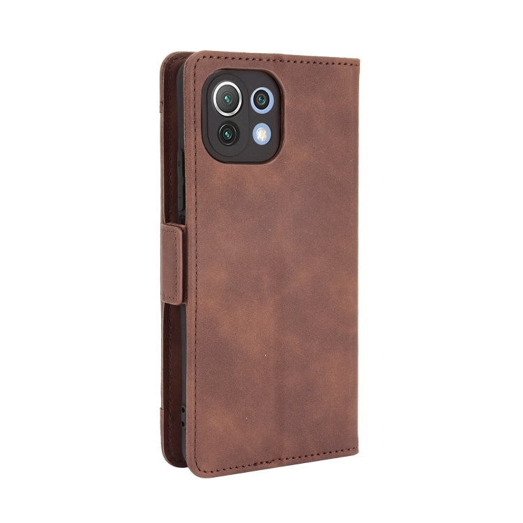 For Xiaomi Mi 11 Lite 4G / Mi 11 Lite 5G Skin Feel Calf Pattern Horizontal Flip Leather Case with Holder & Card Slots & Photo Frame