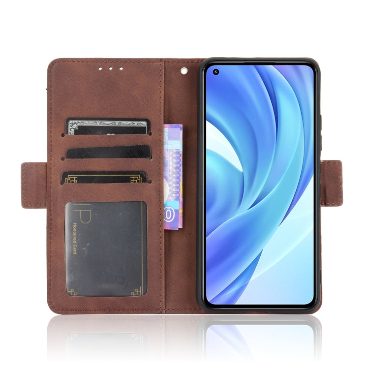 For Xiaomi Mi 11 Lite 4G / Mi 11 Lite 5G Skin Feel Calf Pattern Horizontal Flip Leather Case with Holder & Card Slots & Photo Frame