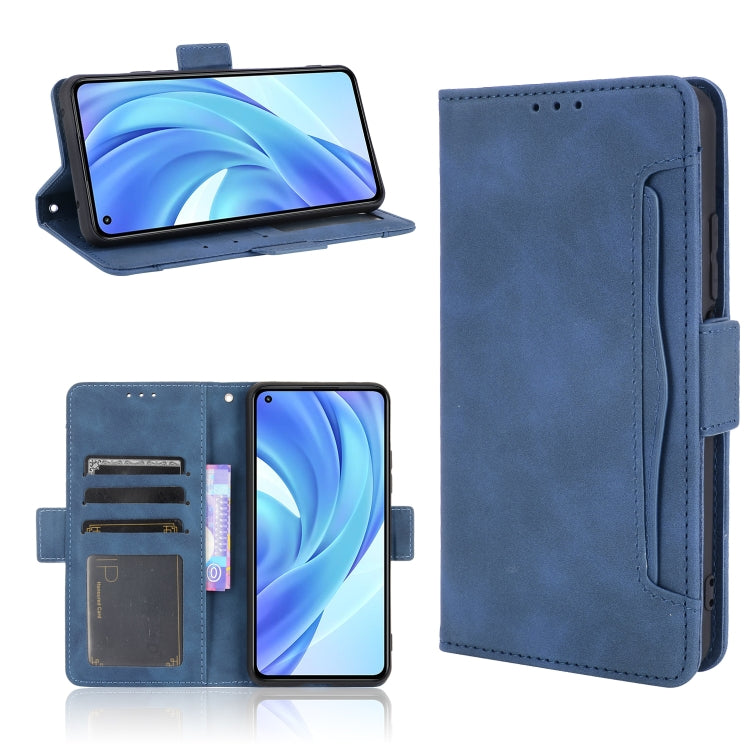 For Xiaomi Mi 11 Lite 4G / Mi 11 Lite 5G Skin Feel Calf Pattern Horizontal Flip Leather Case with Holder & Card Slots & Photo Frame