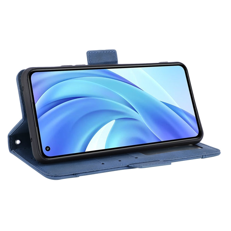 For Xiaomi Mi 11 Lite 4G / Mi 11 Lite 5G Skin Feel Calf Pattern Horizontal Flip Leather Case with Holder & Card Slots & Photo Frame