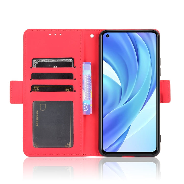 For Xiaomi Mi 11 Lite 4G / Mi 11 Lite 5G Skin Feel Calf Pattern Horizontal Flip Leather Case with Holder & Card Slots & Photo Frame