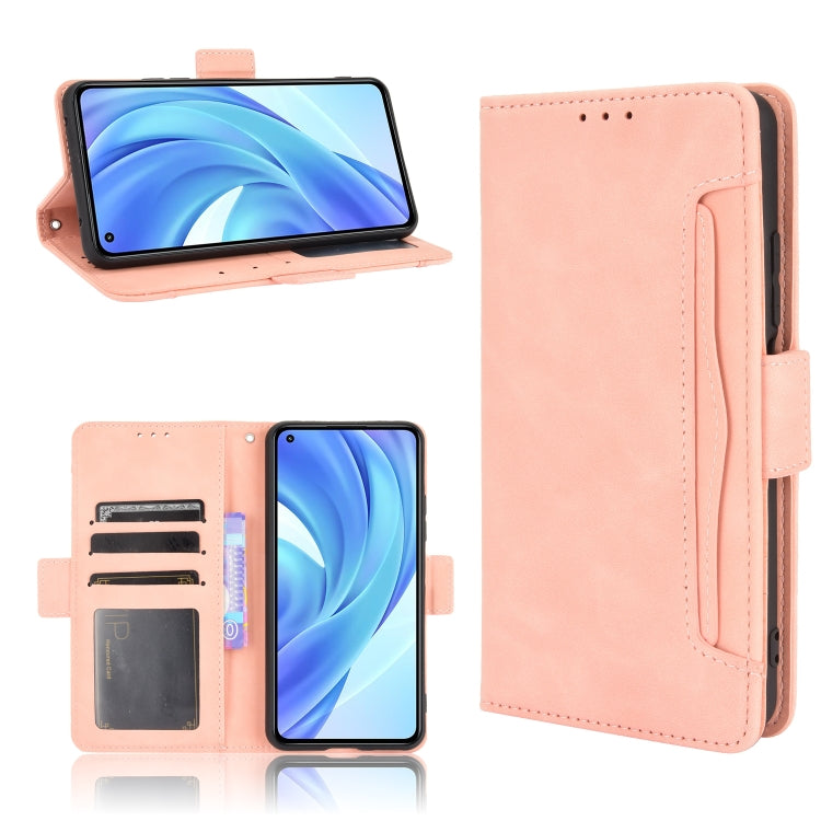 For Xiaomi Mi 11 Lite 4G / Mi 11 Lite 5G Skin Feel Calf Pattern Horizontal Flip Leather Case with Holder & Card Slots & Photo Frame