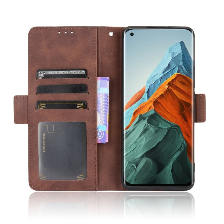 For Xiaomi Mi 11 Pro Skin Feel Calf Pattern Horizontal Flip Leather Case with Holder & Card Slots & Photo Frame