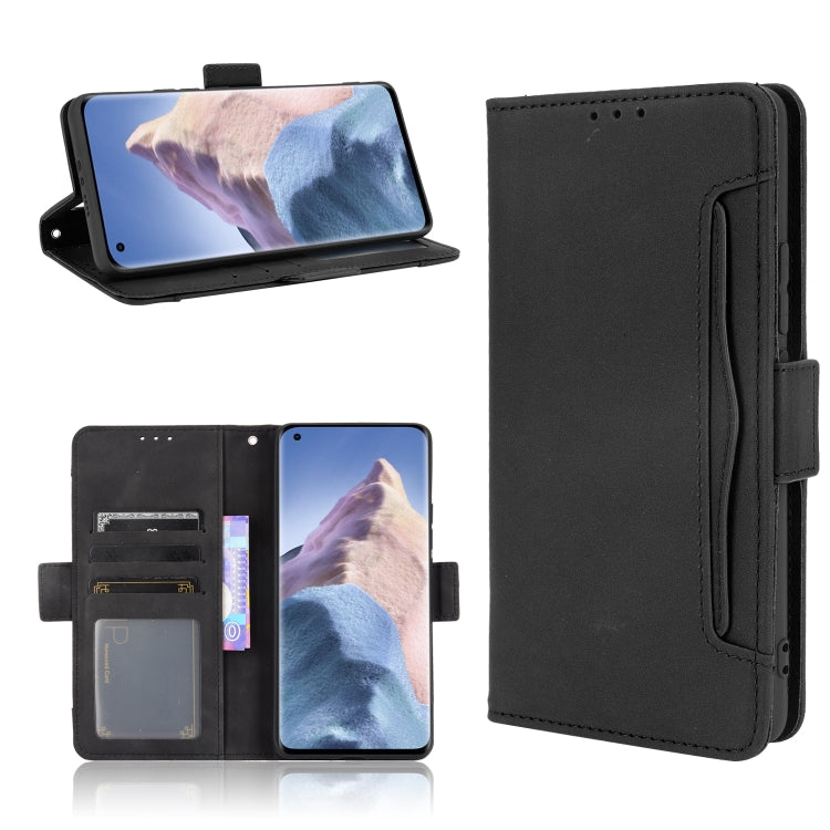 For Xiaomi Mi 11 Ultra Skin Feel Calf Pattern Horizontal Flip Leather Case with Holder & Card Slots & Photo Frame