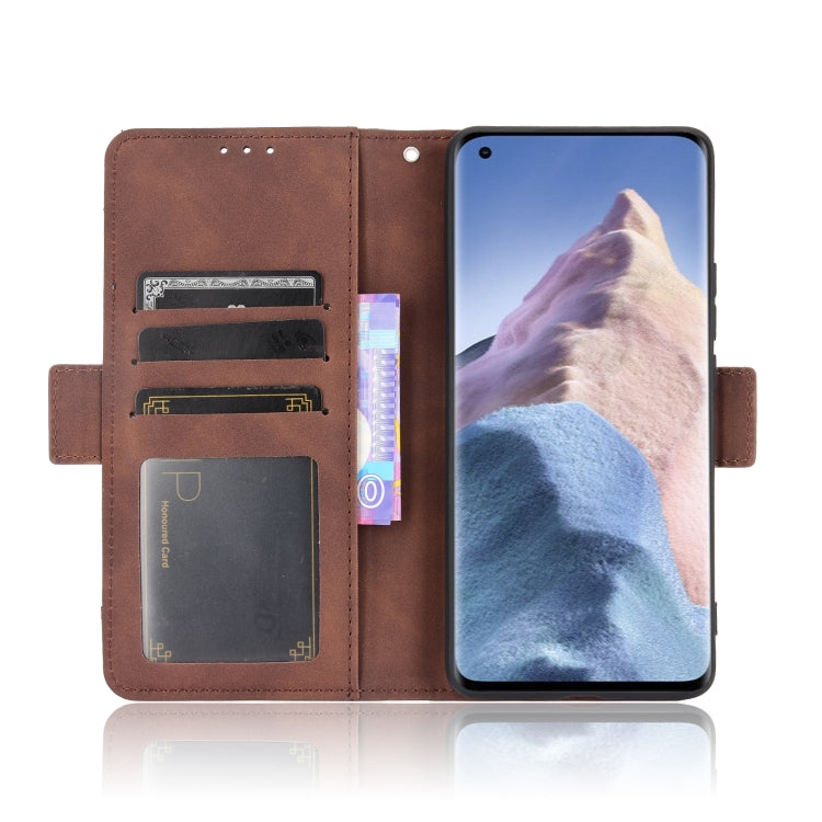 For Xiaomi Mi 11 Ultra Skin Feel Calf Pattern Horizontal Flip Leather Case with Holder & Card Slots & Photo Frame