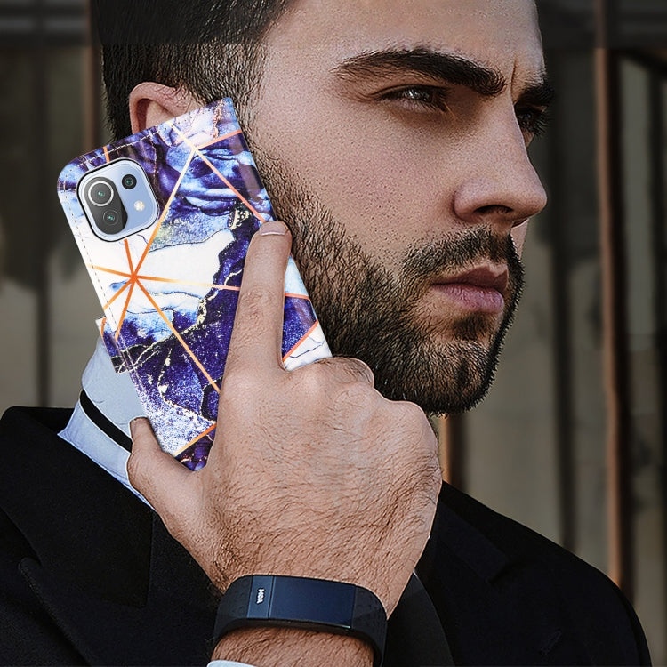 For Xiaomi Mi 11 Lite Marble Stitching Horizontal Flip PU Leather Case with Holder & Card Slots & Wallet & Lanyard