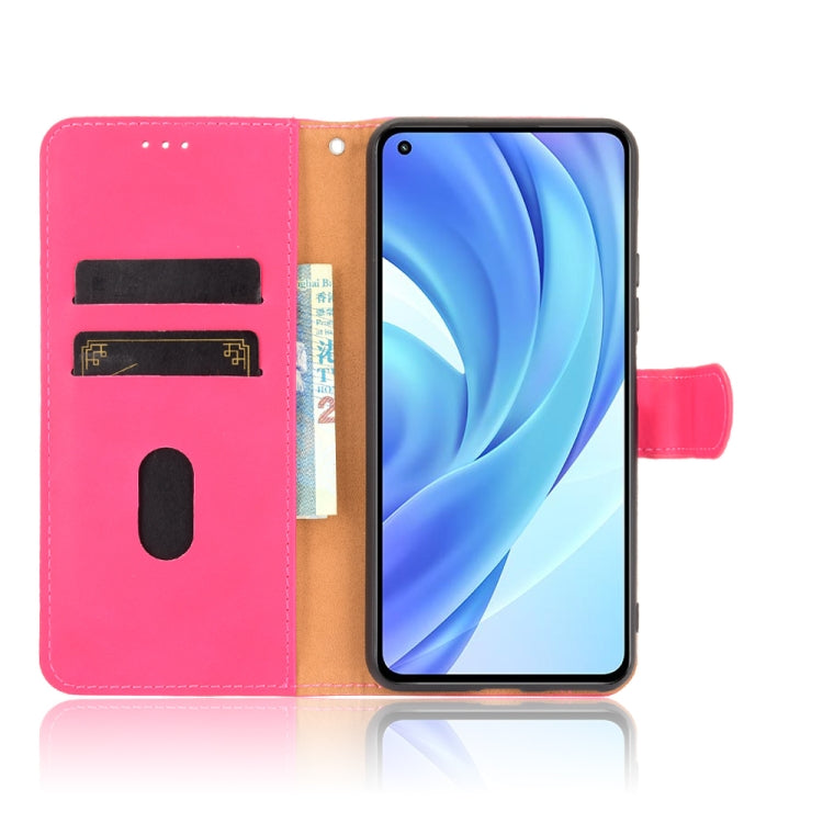 For Xiaomi Mi 11 Lite Solid Color Skin Feel Magnetic Buckle Horizontal Flip Calf Texture PU Leather Case with Holder & Card Slots & Wallet