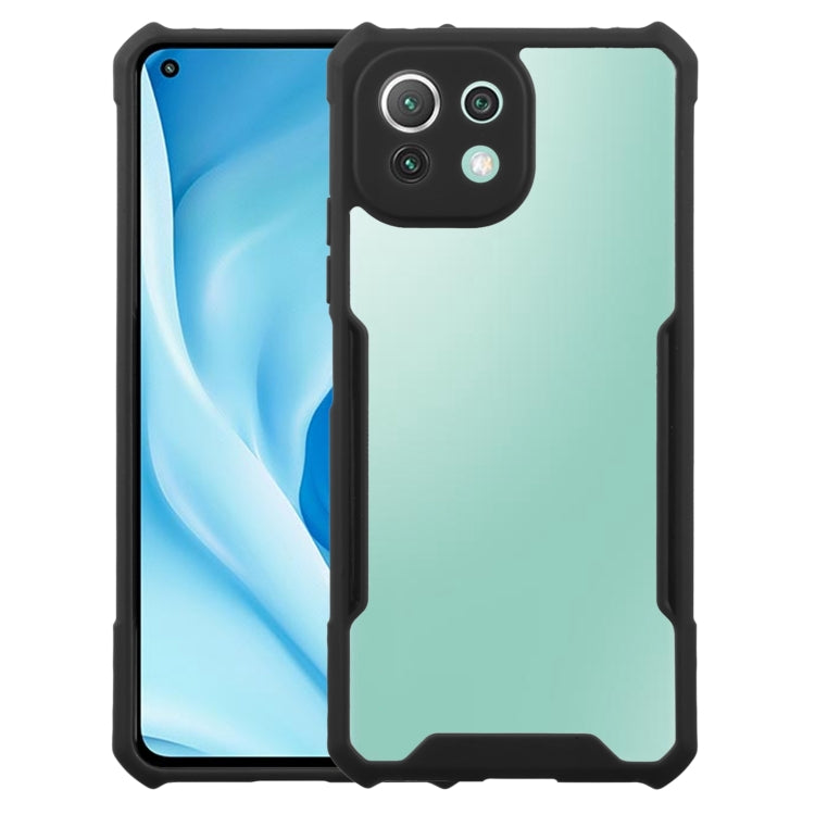 For Xiaomi Mi 11 Lite Acrylic + Color TPU Shockproof Case