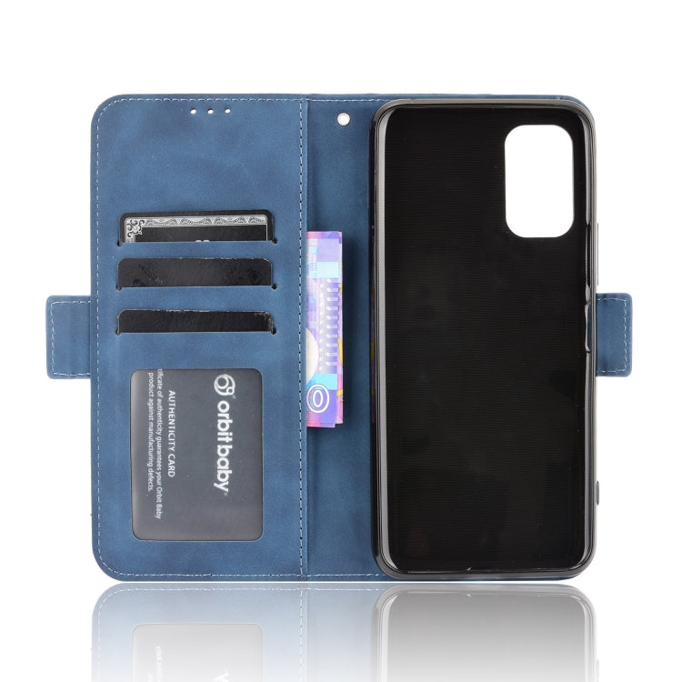 For Xiaomi Redmi Note 10 JP Version Skin Feel Calf Pattern Horizontal Flip Leather Case with Holder & Card Slots & Photo Frame