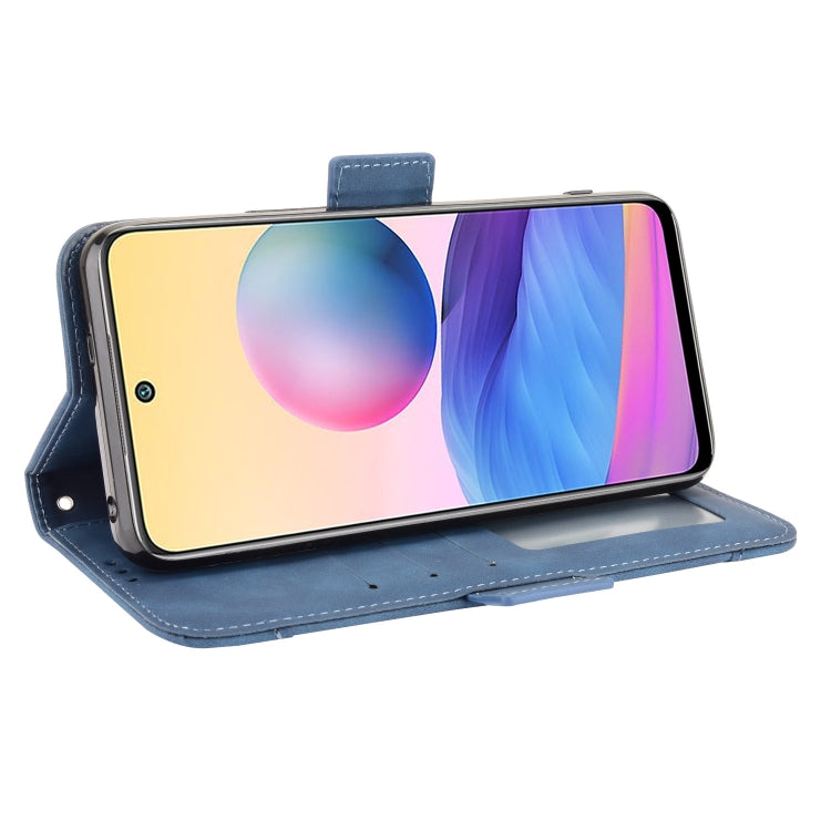 For Xiaomi Redmi Note 10 JP Version Skin Feel Calf Pattern Horizontal Flip Leather Case with Holder & Card Slots & Photo Frame