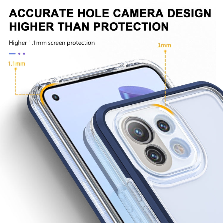 For Xiaomi Mi 11 Lite Bright Series Clear Acrylic + PC + TPU Shockproof Case