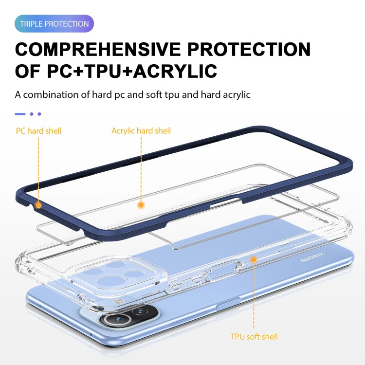 For Xiaomi Mi 11 Lite Bright Series Clear Acrylic + PC + TPU Shockproof Case