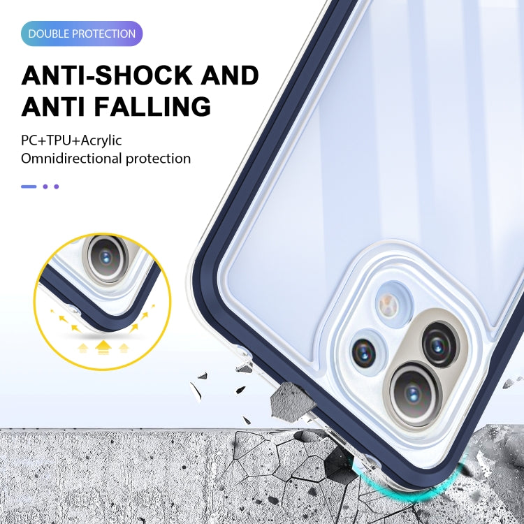 For Xiaomi Mi 11 Lite Bright Series Clear Acrylic + PC + TPU Shockproof Case