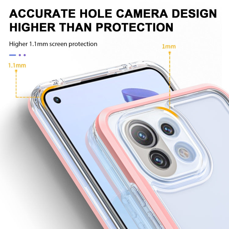 For Xiaomi Mi 11 Lite Bright Series Clear Acrylic + PC + TPU Shockproof Case
