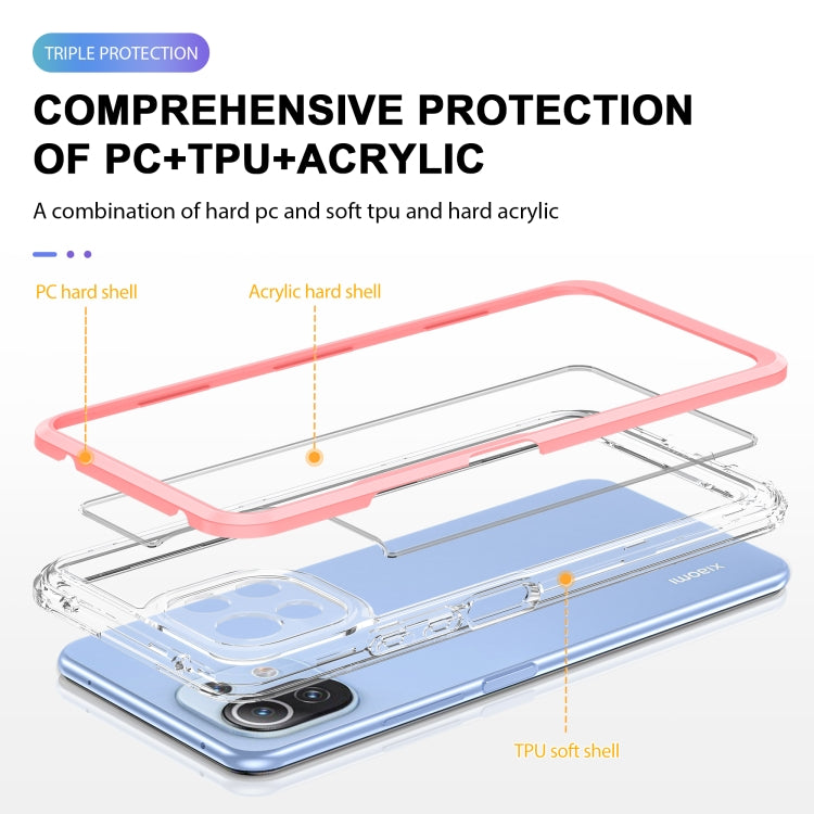 For Xiaomi Mi 11 Lite Bright Series Clear Acrylic + PC + TPU Shockproof Case