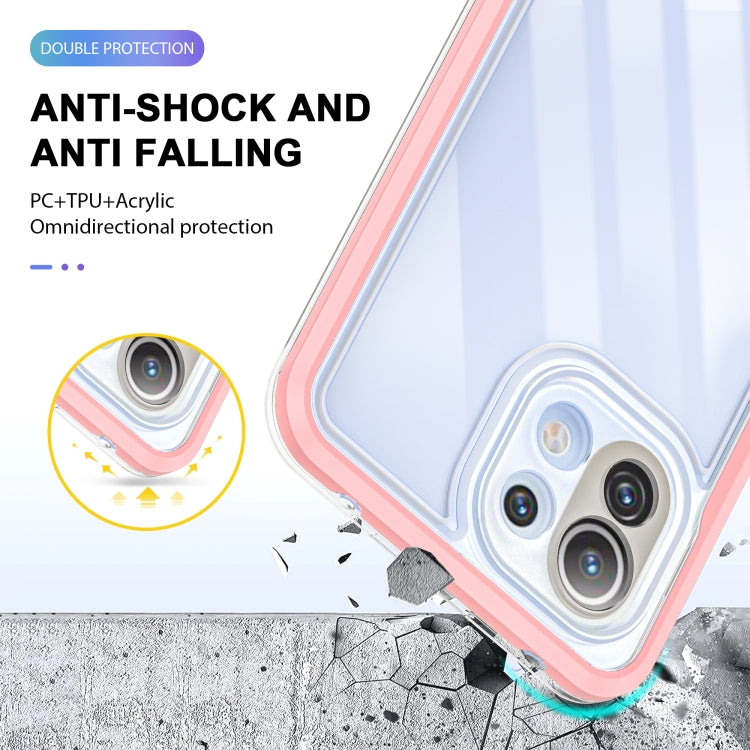 For Xiaomi Mi 11 Lite Bright Series Clear Acrylic + PC + TPU Shockproof Case