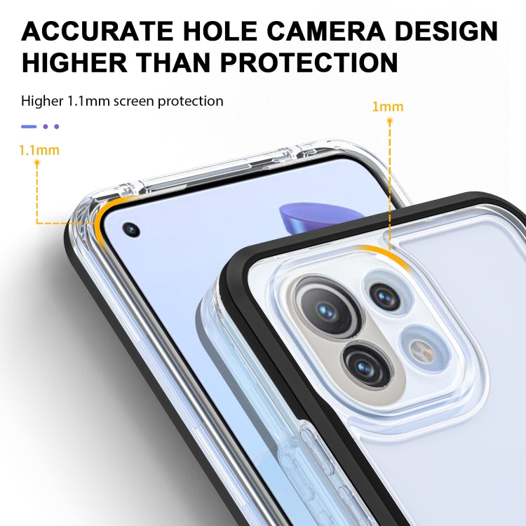 For Xiaomi Mi 11 Lite Bright Series Clear Acrylic + PC + TPU Shockproof Case