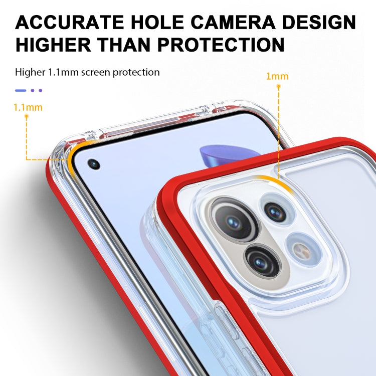 For Xiaomi Mi 11 Lite Bright Series Clear Acrylic + PC + TPU Shockproof Case
