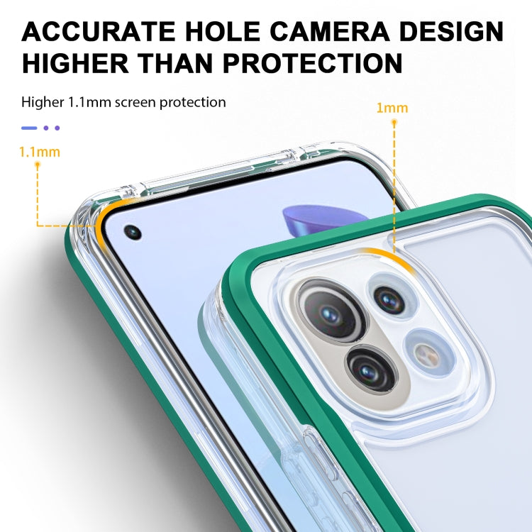 For Xiaomi Mi 11 Lite Bright Series Clear Acrylic + PC + TPU Shockproof Case