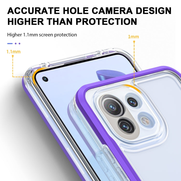 For Xiaomi Mi 11 Lite Bright Series Clear Acrylic + PC + TPU Shockproof Case