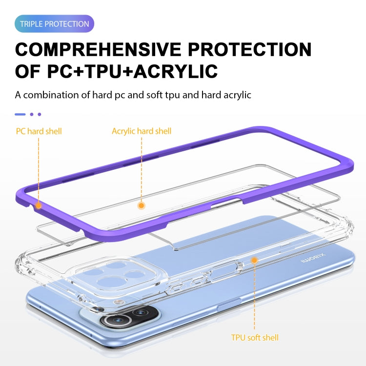 For Xiaomi Mi 11 Lite Bright Series Clear Acrylic + PC + TPU Shockproof Case