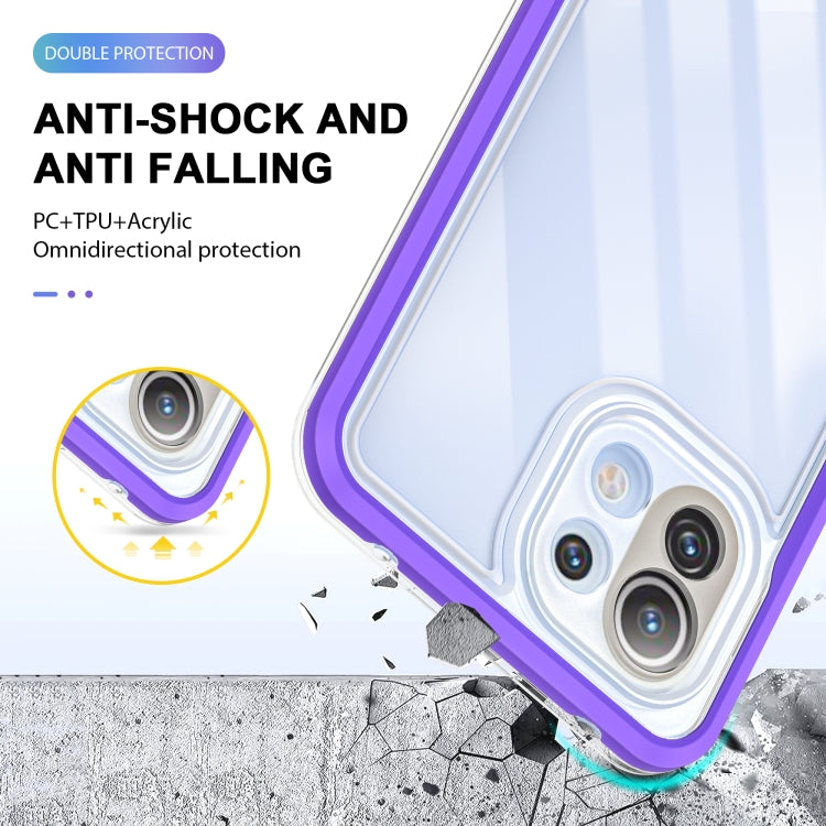 For Xiaomi Mi 11 Lite Bright Series Clear Acrylic + PC + TPU Shockproof Case