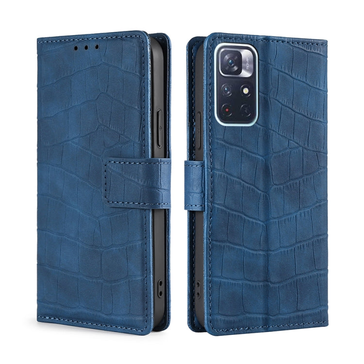 For Xiaomi Redmi Note 11 Skin Feel Crocodile Texture Magnetic Clasp Horizontal Flip Leather Phone Case with Holder & Card Slots & Wallet