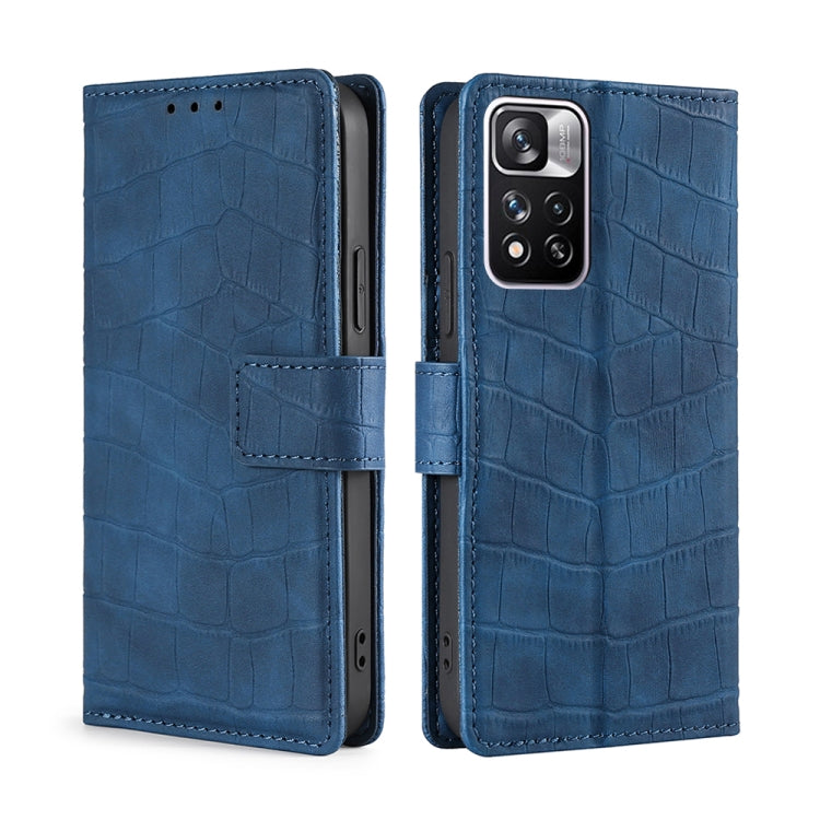 For Xiaomi Redmi Note 11 Pro Skin Feel Crocodile Texture Magnetic Clasp Horizontal Flip Leather Phone Case with Holder & Card Slots & Wallet