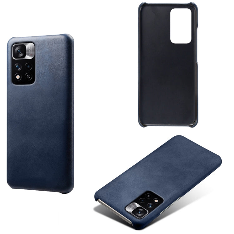 For Xiaomi Redmi Note 11 Pro+ Calf Texture PC + PU Phone Case