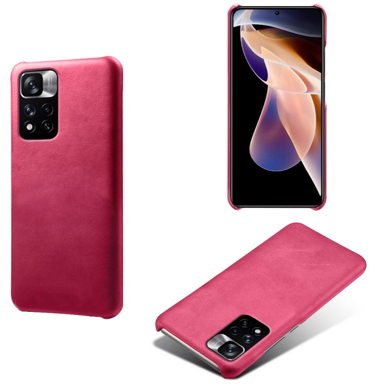 For Xiaomi Redmi Note 11 Pro+ Calf Texture PC + PU Phone Case