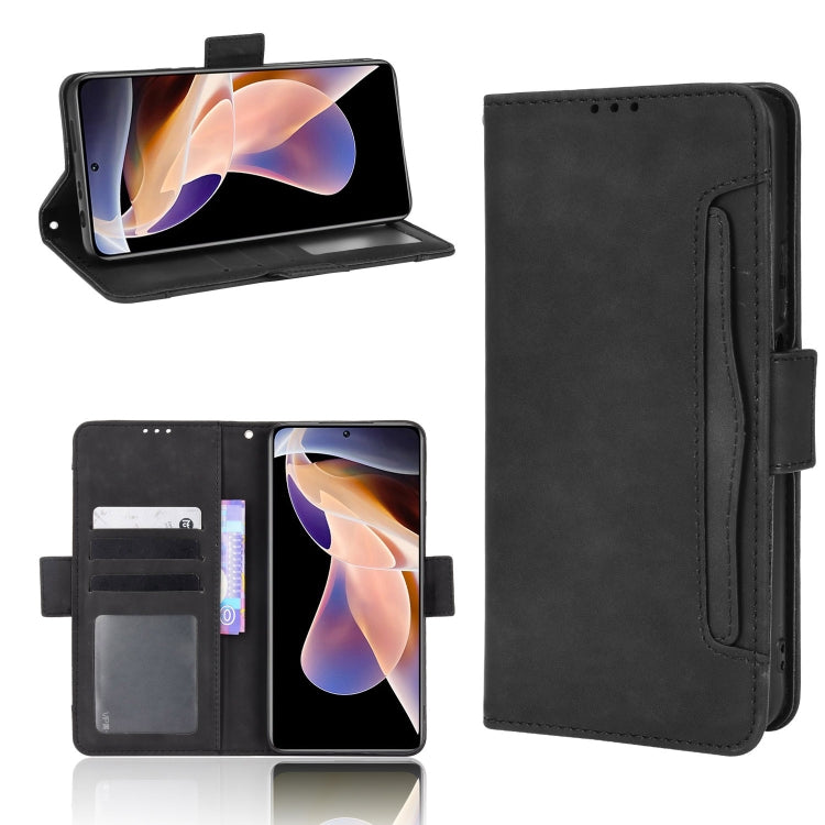 For Xiaomi Redmi Note 11 Pro Skin Feel Calf Pattern Leather Phone Case