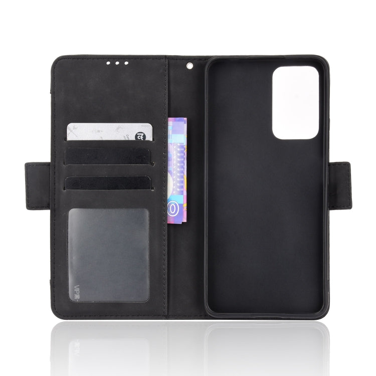 For Xiaomi Redmi Note 11 Pro Skin Feel Calf Pattern Leather Phone Case