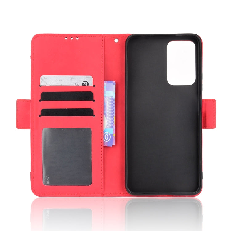 For Xiaomi Redmi Note 11 Pro Skin Feel Calf Pattern Leather Phone Case