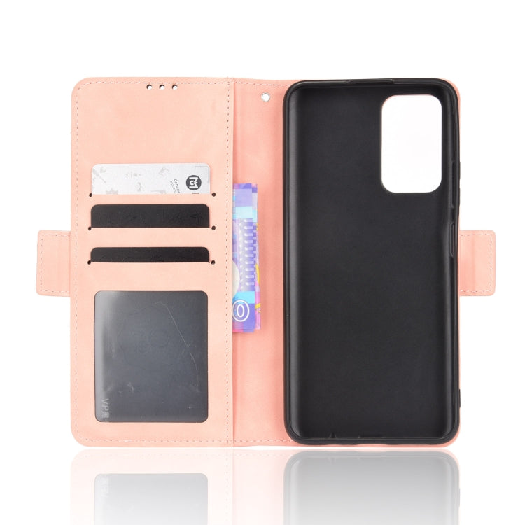 For Xiaomi Redmi Note 11 5G Domestic Version / Poco M4 Pro Skin Feel Calf Pattern Leather Phone Case