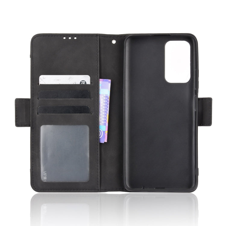 For Xiaomi Redmi Note 11 5G Domestic Version / Poco M4 Pro Skin Feel Calf Pattern Leather Phone Case