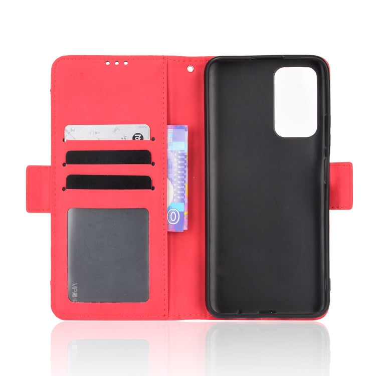 For Xiaomi Redmi Note 11 5G Domestic Version / Poco M4 Pro Skin Feel Calf Pattern Leather Phone Case