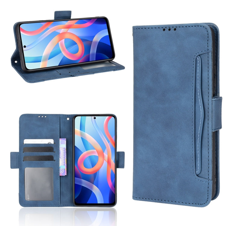 For Xiaomi Redmi Note 11 5G Domestic Version / Poco M4 Pro Skin Feel Calf Pattern Leather Phone Case