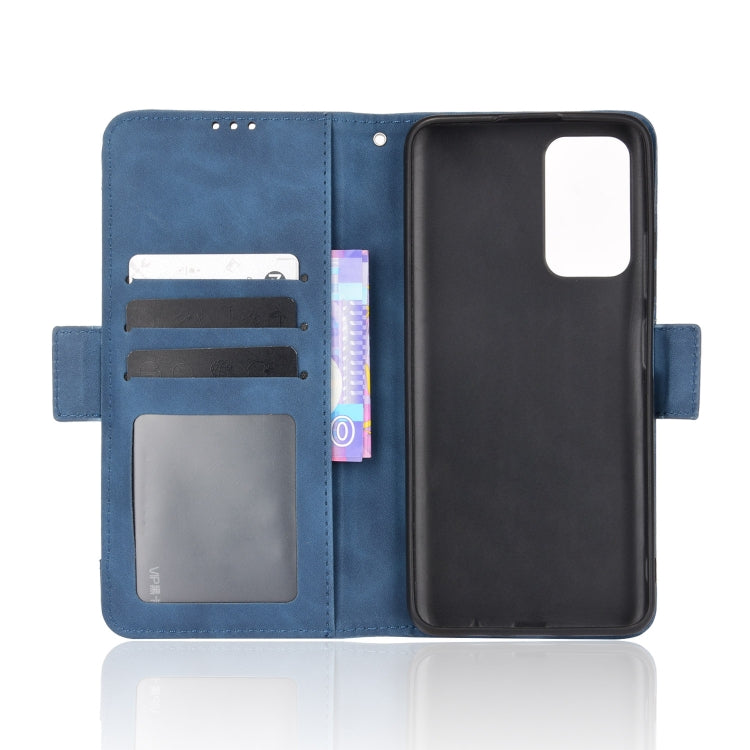 For Xiaomi Redmi Note 11 5G Domestic Version / Poco M4 Pro Skin Feel Calf Pattern Leather Phone Case