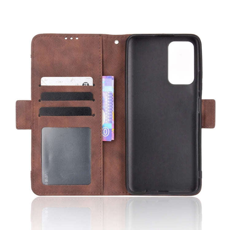 For Xiaomi Redmi Note 11 5G Domestic Version / Poco M4 Pro Skin Feel Calf Pattern Leather Phone Case