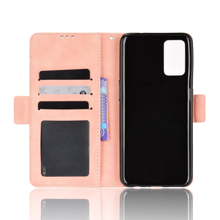For OPPO A55s 5G JP Version Skin Feel Calf Pattern Leather Phone Case