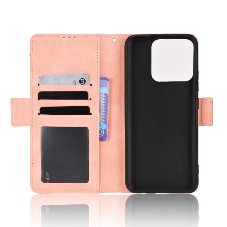 For OPPO Realme Narzo 50A Skin Feel Calf Pattern Leather Phone Case