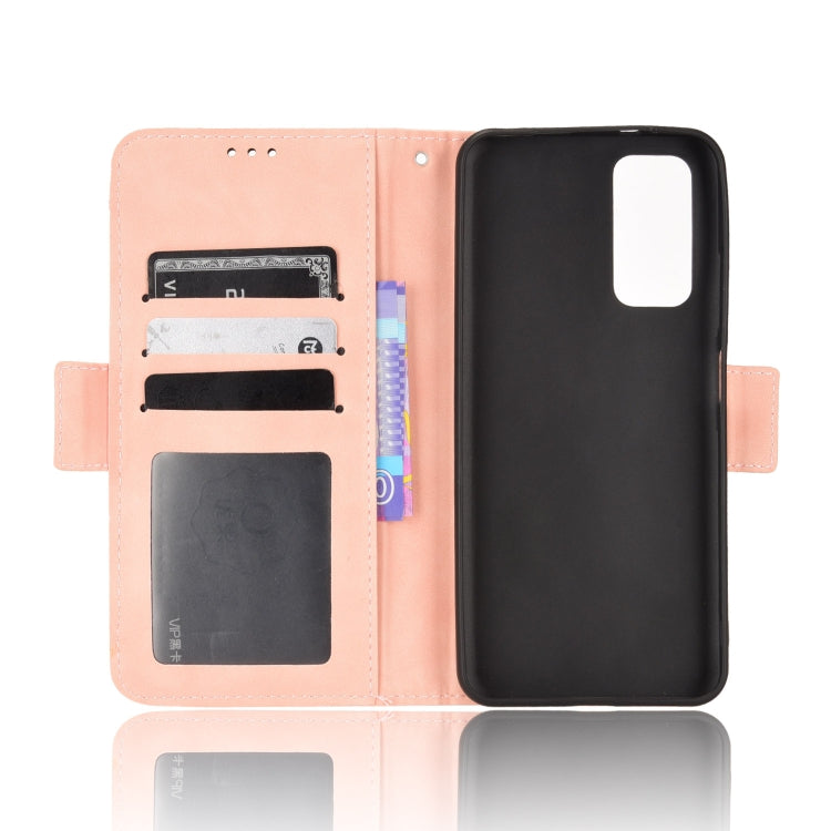 For Xiaomi Redmi Note 11S / Note 11 4G Overseas Version Skin Feel Calf Pattern Leather Phone Case