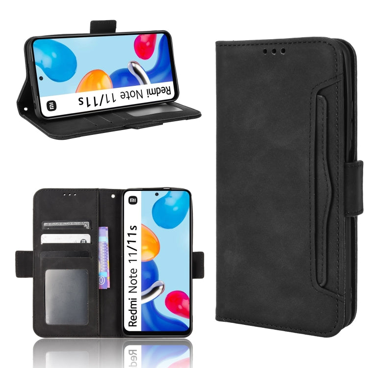 For Xiaomi Redmi Note 11S / Note 11 4G Overseas Version Skin Feel Calf Pattern Leather Phone Case