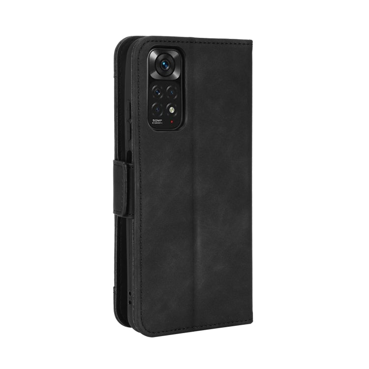 For Xiaomi Redmi Note 11S / Note 11 4G Overseas Version Skin Feel Calf Pattern Leather Phone Case