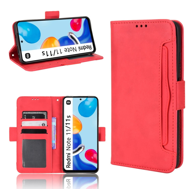 For Xiaomi Redmi Note 11S / Note 11 4G Overseas Version Skin Feel Calf Pattern Leather Phone Case