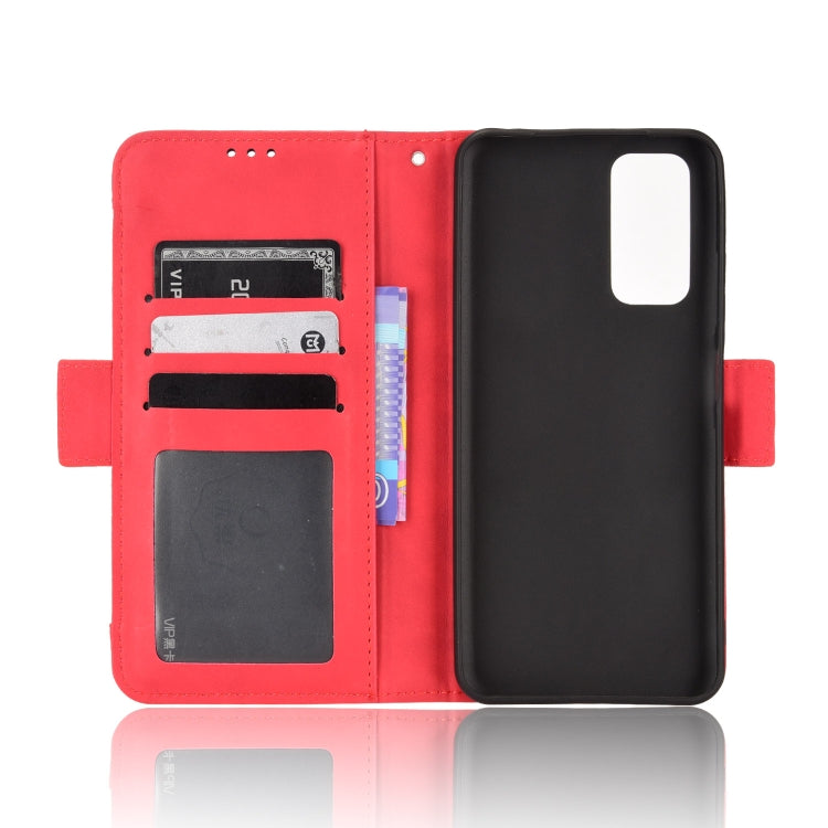 For Xiaomi Redmi Note 11S / Note 11 4G Overseas Version Skin Feel Calf Pattern Leather Phone Case